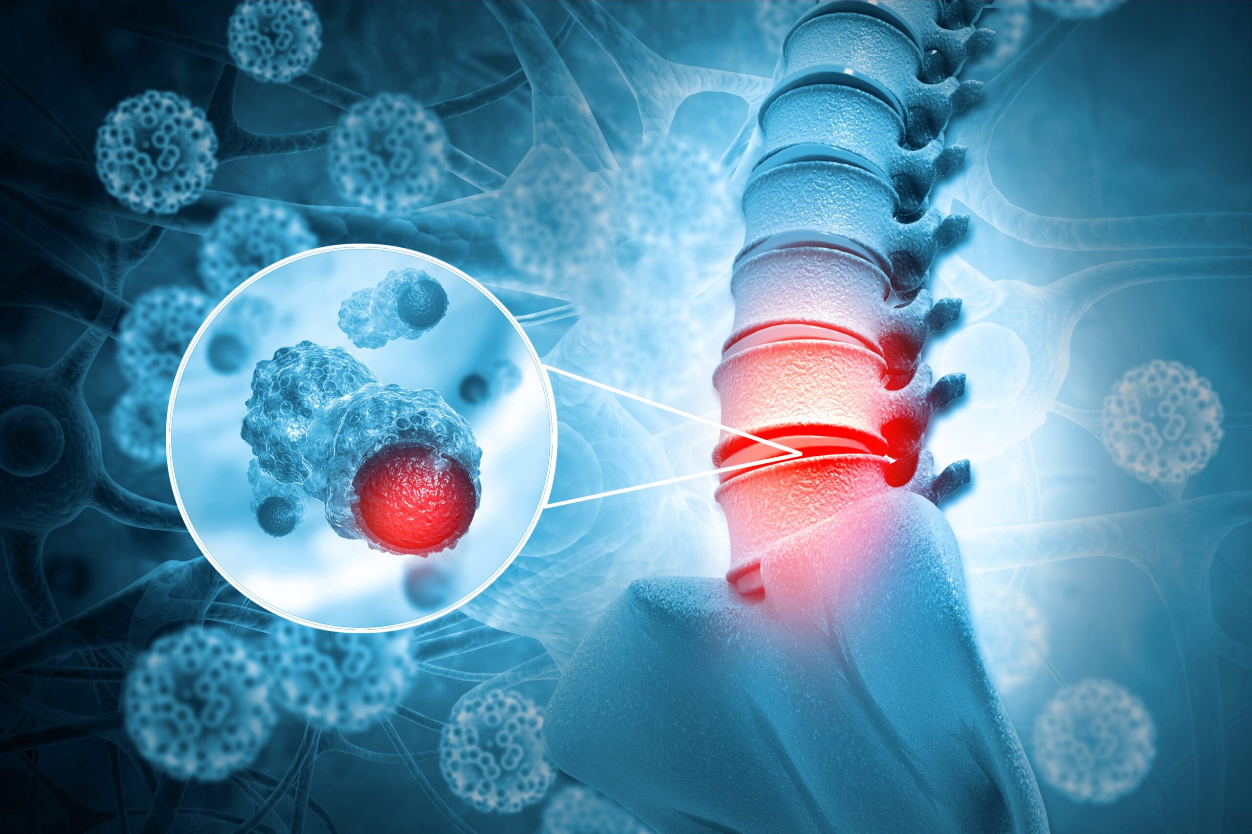 Charting Bone Cancer: Research Trends and Market Insights | DLI